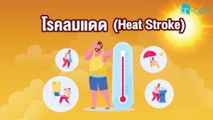 โรคลมแดด (Heat Stroke)